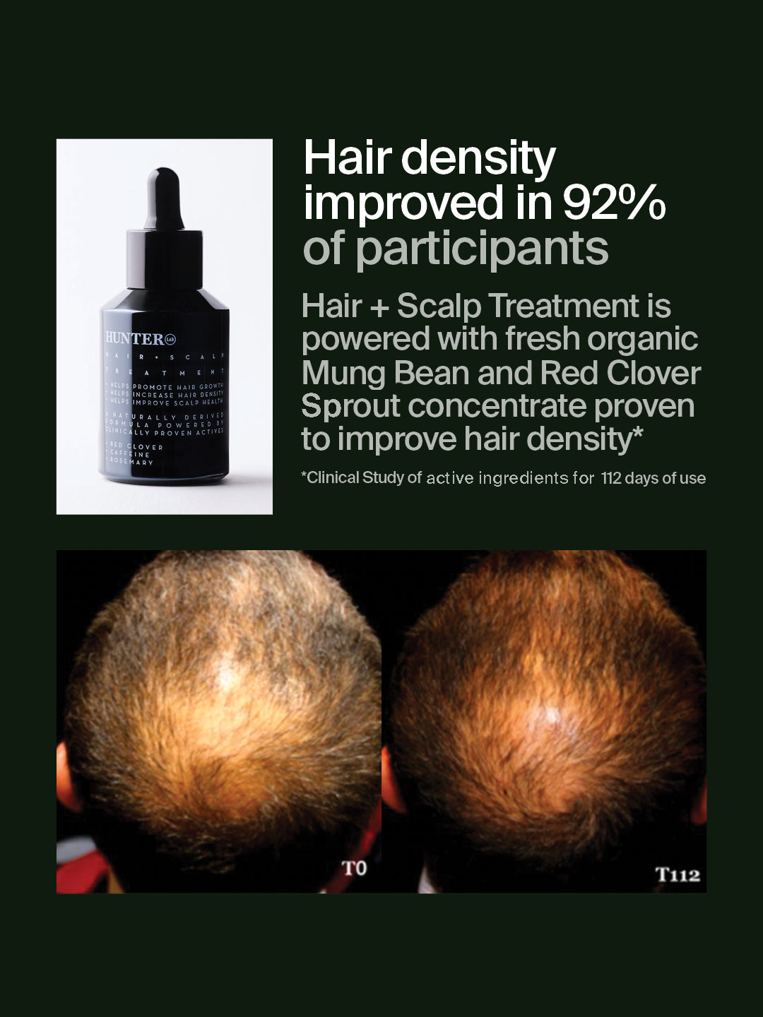 Hair + Scalp Treatment 50ml